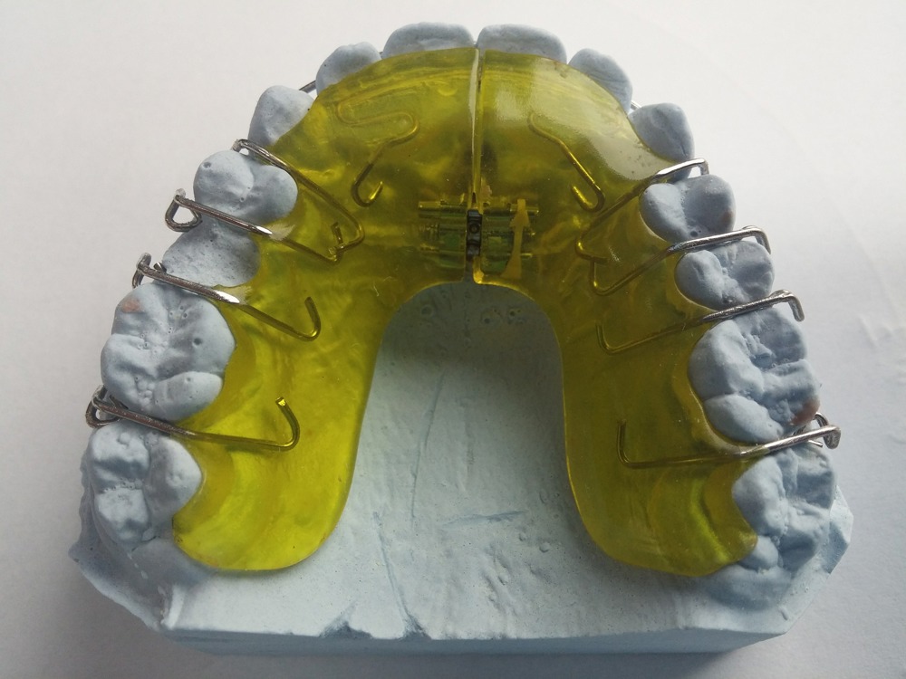 Зъбните протези - предимства и недостатъци