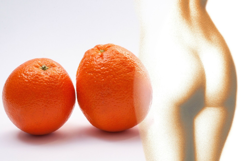 Целулитът и портокаловата кожа не щади и слабите